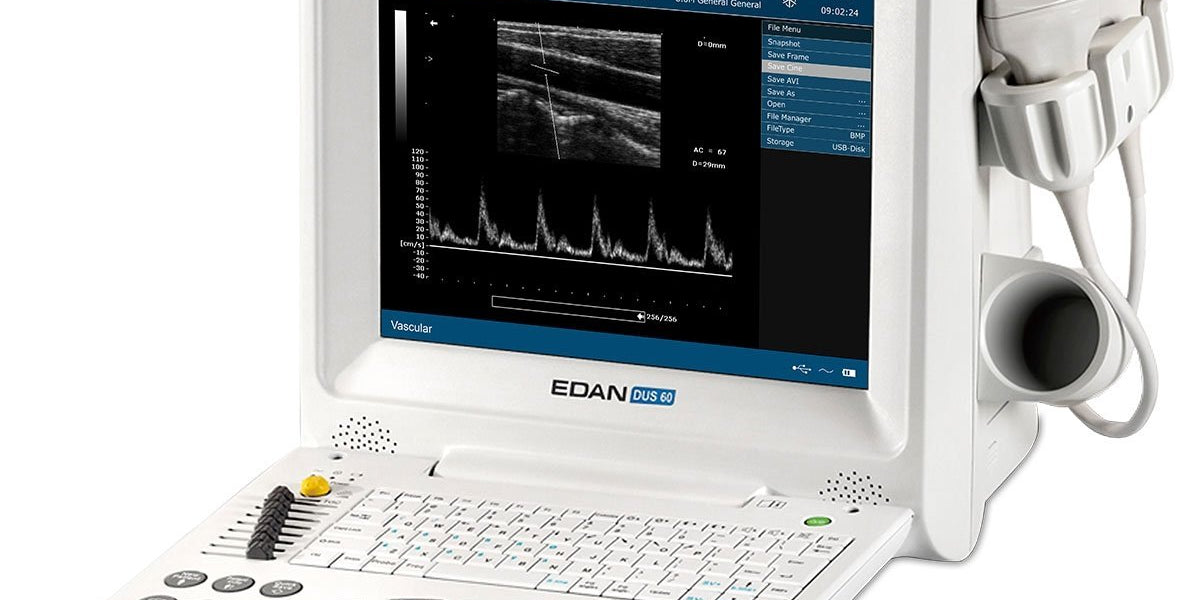 Edan DUS 60 Digital Ultrasound — Victori Medical