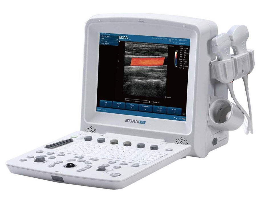 Edan U50 Prime Diagnostic Ultrasound System - Alternative Source Medical