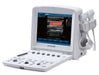 Edan U50 Prime Diagnostic Ultrasound System - Alternative Source Medical